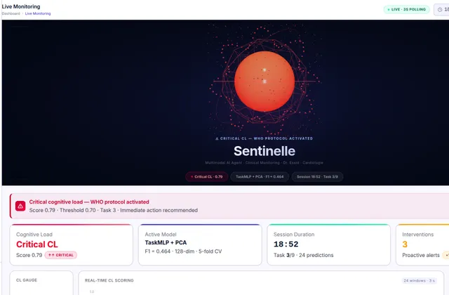 Tableau de bord Sentinelle : surveillance en direct de la charge cognitive avec alerte critique